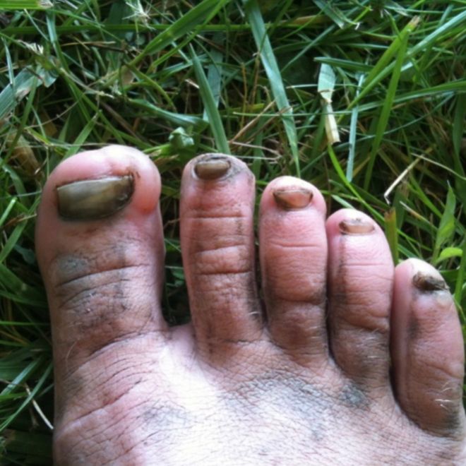 How to get your feet ready to run - ActiveEquip Guest blog by Emily Donker